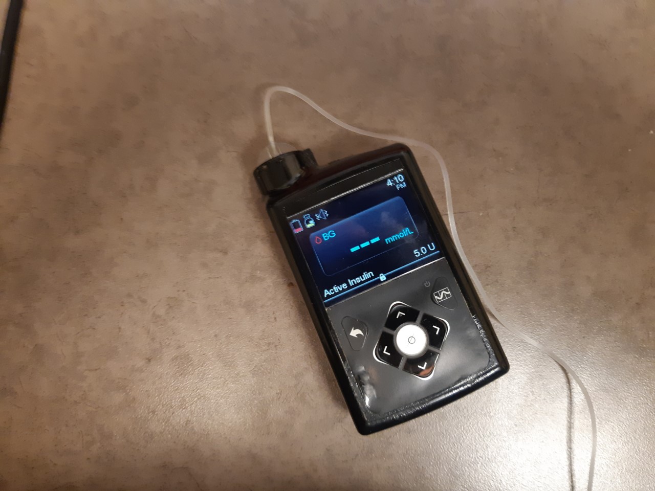 Outcry forces Government to pause insulin pump plan changes CochraneNow Cochrane, Alberta's