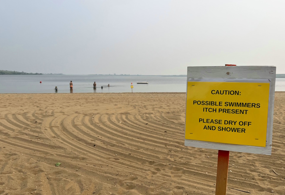 Saskatchewan residents reminded how to prevent swimmer's itch as cases are reported